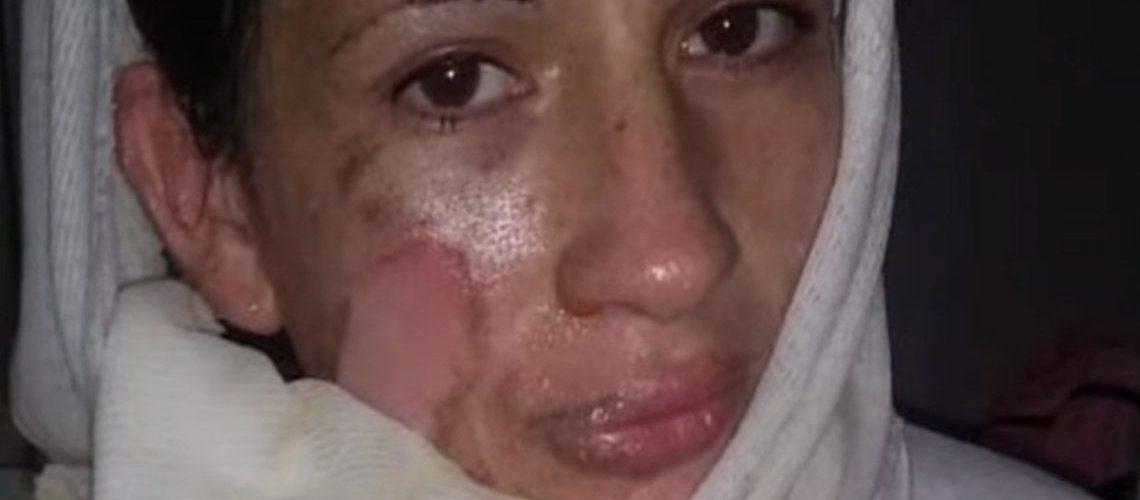 Horror en Bahía Blanca: su novio la prendió fuego frente a sus hijas